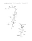 Paranasal Ostium Finder Devices and Methods diagram and image