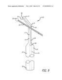 Paranasal Ostium Finder Devices and Methods diagram and image