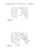 Paranasal Ostium Finder Devices and Methods diagram and image