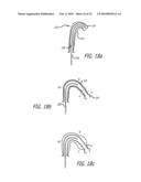 Paranasal Ostium Finder Devices and Methods diagram and image