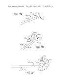 Paranasal Ostium Finder Devices and Methods diagram and image