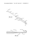 Paranasal Ostium Finder Devices and Methods diagram and image