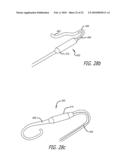 Paranasal Ostium Finder Devices and Methods diagram and image