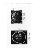 Vibrotactile devices for controlled somato sensory stimulus during functionalmagnetic resonance imaging diagram and image