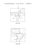 SYSTEMS AND METHODS FOR ANESTHETIZING EAR TISSUE diagram and image