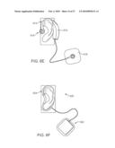 SYSTEMS AND METHODS FOR ANESTHETIZING EAR TISSUE diagram and image