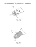 SYSTEMS AND METHODS FOR ANESTHETIZING EAR TISSUE diagram and image