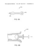 SYSTEMS AND METHODS FOR ANESTHETIZING EAR TISSUE diagram and image