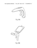 APPARATUS AND METHOD FOR WOUND, CAVITY, AND BONE TREATMENT diagram and image