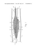  RAPID-EXCHANGE CATHETER diagram and image