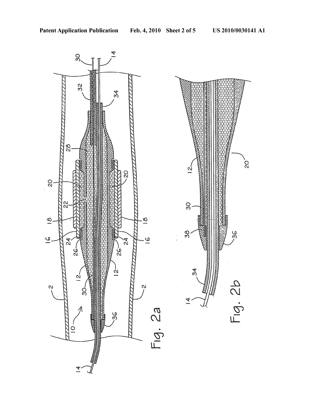  RAPID-EXCHANGE CATHETER - diagram, schematic, and image 03