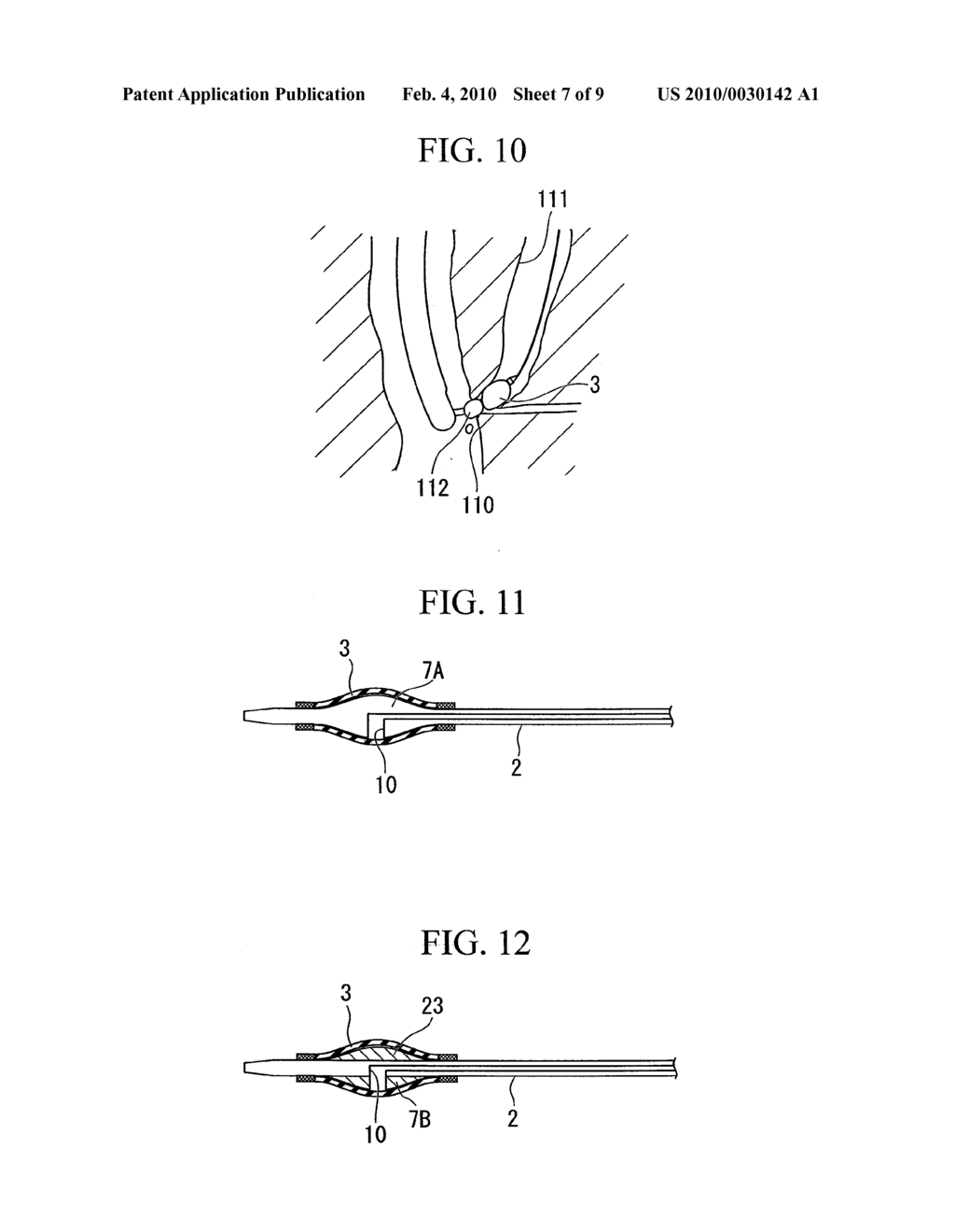 BALLOON CATHETER AND SHEATH FABRICATION METHOD - diagram, schematic, and image 08