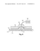 APPARATUS FOR GUIDING THE PLACEMENT OF A SUBCUTANEOUS DEVICE diagram and image