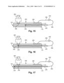 APPARATUS FOR GUIDING THE PLACEMENT OF A SUBCUTANEOUS DEVICE diagram and image