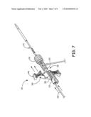 MEDICAL INSTRUMENT INSERTER diagram and image