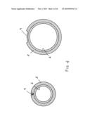 Stretchable-diameter inserter for hemodynamic studies and related operations diagram and image