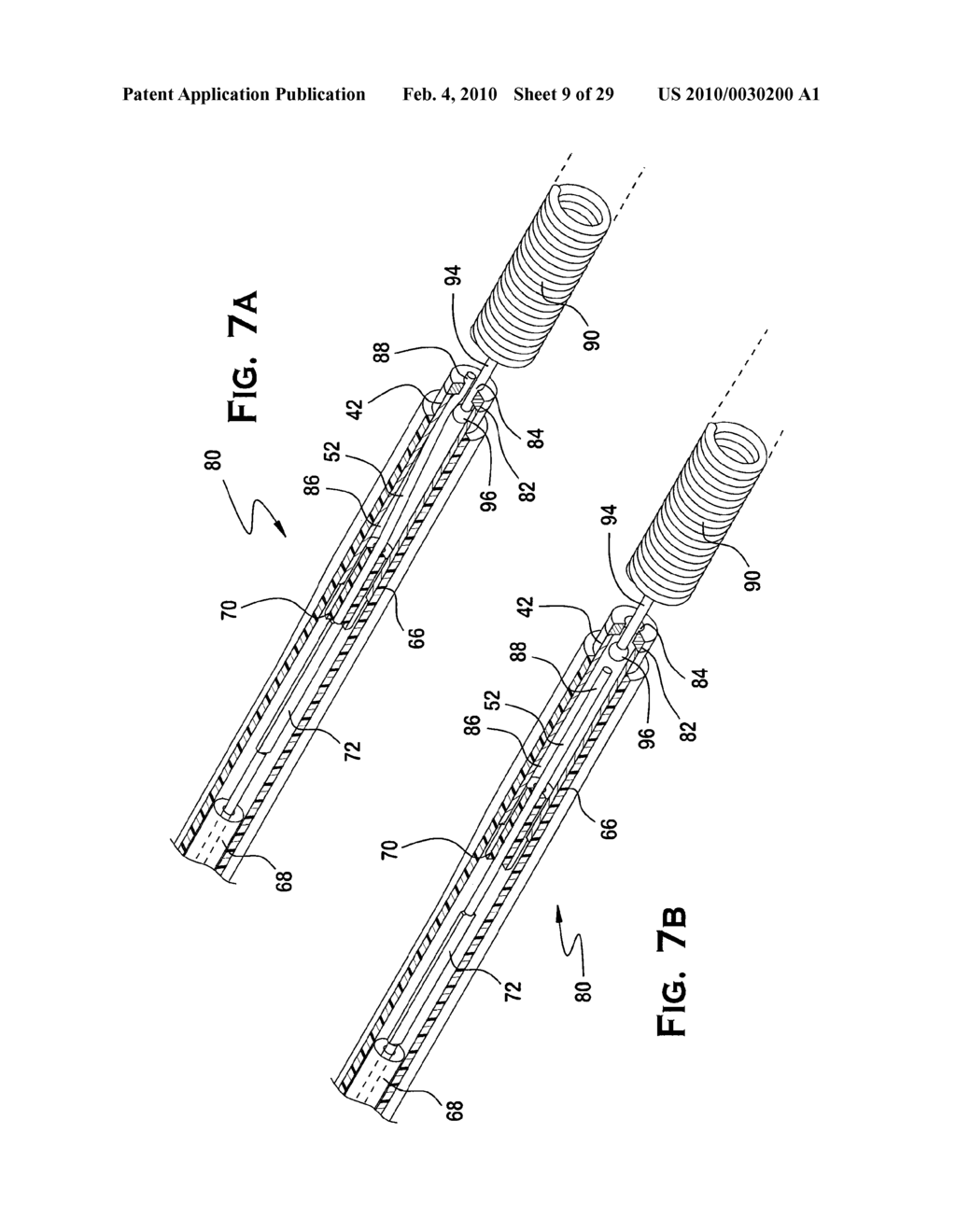 SYSTEM AND METHOD FOR MECHANICALLY POSITIONING INTRAVASCULAR IMPLANTS - diagram, schematic, and image 10