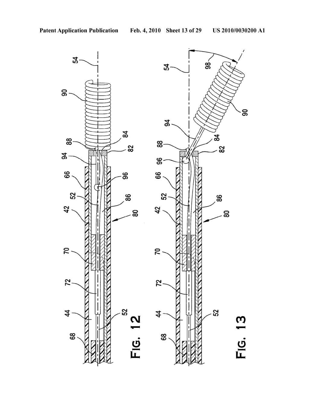 SYSTEM AND METHOD FOR MECHANICALLY POSITIONING INTRAVASCULAR IMPLANTS - diagram, schematic, and image 14