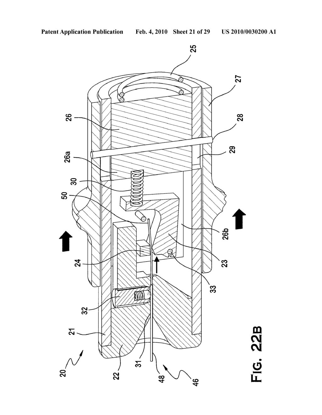 SYSTEM AND METHOD FOR MECHANICALLY POSITIONING INTRAVASCULAR IMPLANTS - diagram, schematic, and image 22