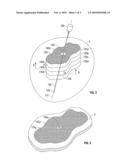 Method for Ablation Volume Determination and Geometric Reconstruction diagram and image