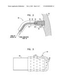 CATHETER WITH PERFORATED TIP diagram and image