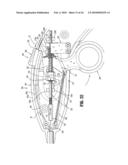 Axial Stitching Device diagram and image