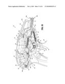 Axial Stitching Device diagram and image