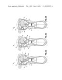 Axial Stitching Device diagram and image