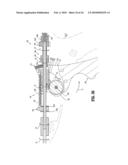 Axial Stitching Device diagram and image