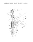 Axial Stitching Device diagram and image