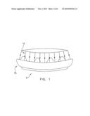 Fixation band for affixing a prosthetic heart valve to tissue diagram and image