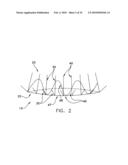 Fixation band for affixing a prosthetic heart valve to tissue diagram and image