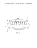 Fixation band for affixing a prosthetic heart valve to tissue diagram and image