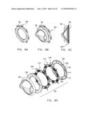 Fixation band for affixing a prosthetic heart valve to tissue diagram and image