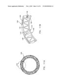 Fixation band for affixing a prosthetic heart valve to tissue diagram and image