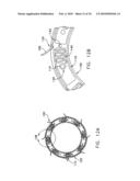 Fixation band for affixing a prosthetic heart valve to tissue diagram and image