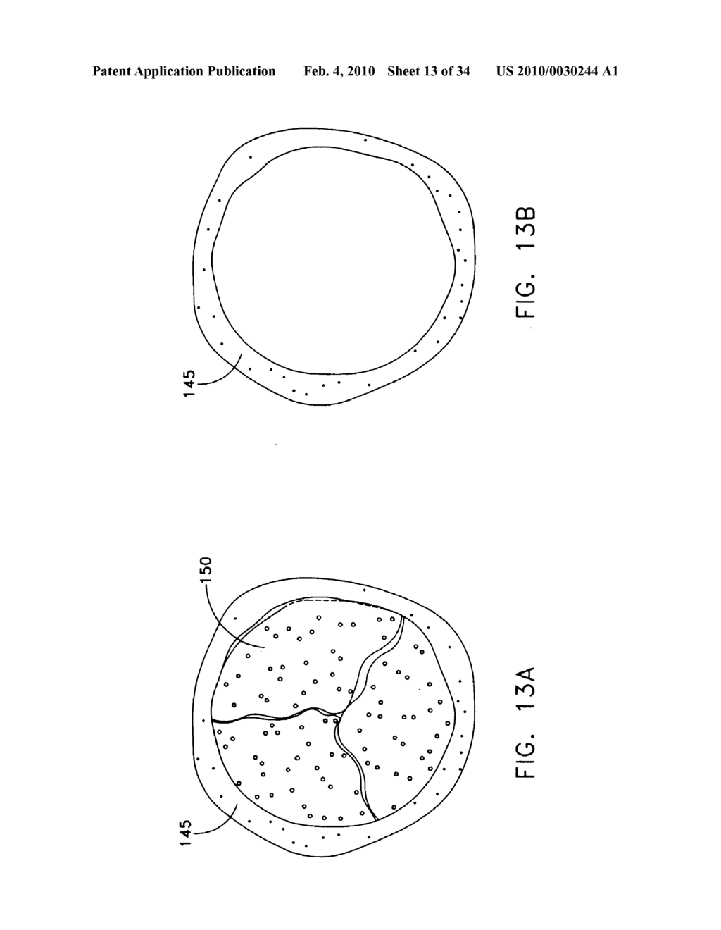 Fixation band for affixing a prosthetic heart valve to tissue - diagram, schematic, and image 14