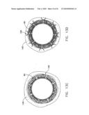 Fixation band for affixing a prosthetic heart valve to tissue diagram and image