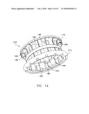 Fixation band for affixing a prosthetic heart valve to tissue diagram and image