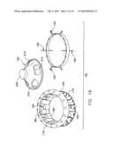 Fixation band for affixing a prosthetic heart valve to tissue diagram and image