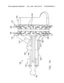 Fixation band for affixing a prosthetic heart valve to tissue diagram and image