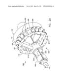 Fixation band for affixing a prosthetic heart valve to tissue diagram and image