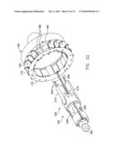 Fixation band for affixing a prosthetic heart valve to tissue diagram and image