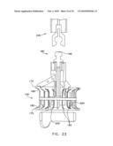 Fixation band for affixing a prosthetic heart valve to tissue diagram and image