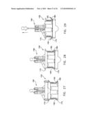 Fixation band for affixing a prosthetic heart valve to tissue diagram and image