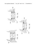 Fixation band for affixing a prosthetic heart valve to tissue diagram and image