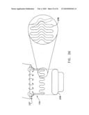 Fixation band for affixing a prosthetic heart valve to tissue diagram and image