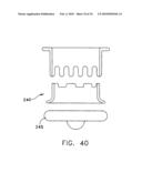 Fixation band for affixing a prosthetic heart valve to tissue diagram and image