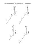 Medical Devices and Methods diagram and image