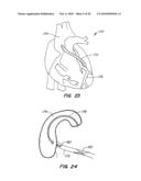 Medical Devices and Methods diagram and image